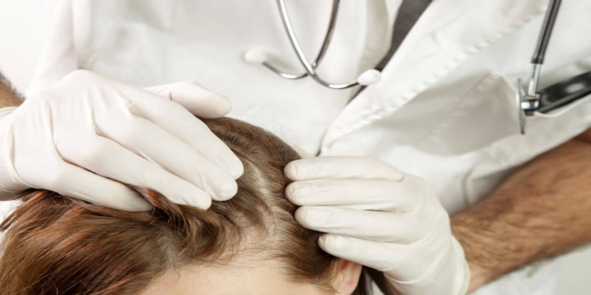 How To Treat Chemical Burns On The Scalp - Hair Explainer