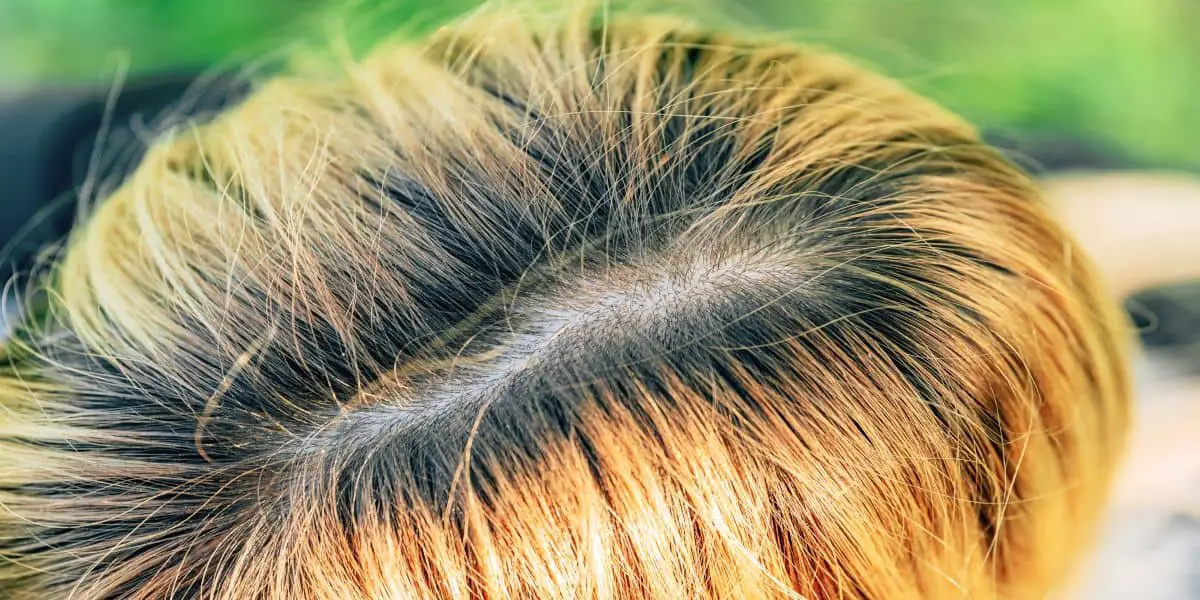 10. "Blonde Hair Shadow Rooted: The Perfect Solution for Grown-Out Roots" - wide 9